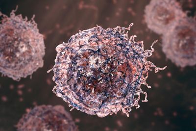 Nanopore-based cell-free DNA fragmentation and methylation profiles from the cerebral spinal fluid of patients with lung cancer brain metastases