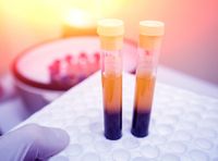 Third-generation nanopore sequencing for post-transplant chimerism monitoring