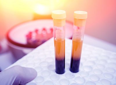 Third-generation nanopore sequencing for post-transplant chimerism monitoring