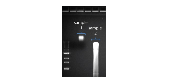 DNA gel2