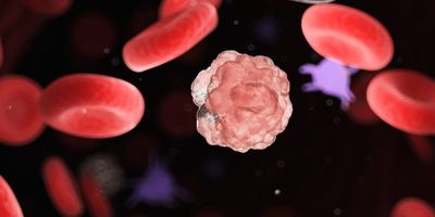 Cancer cell next to red blood cells