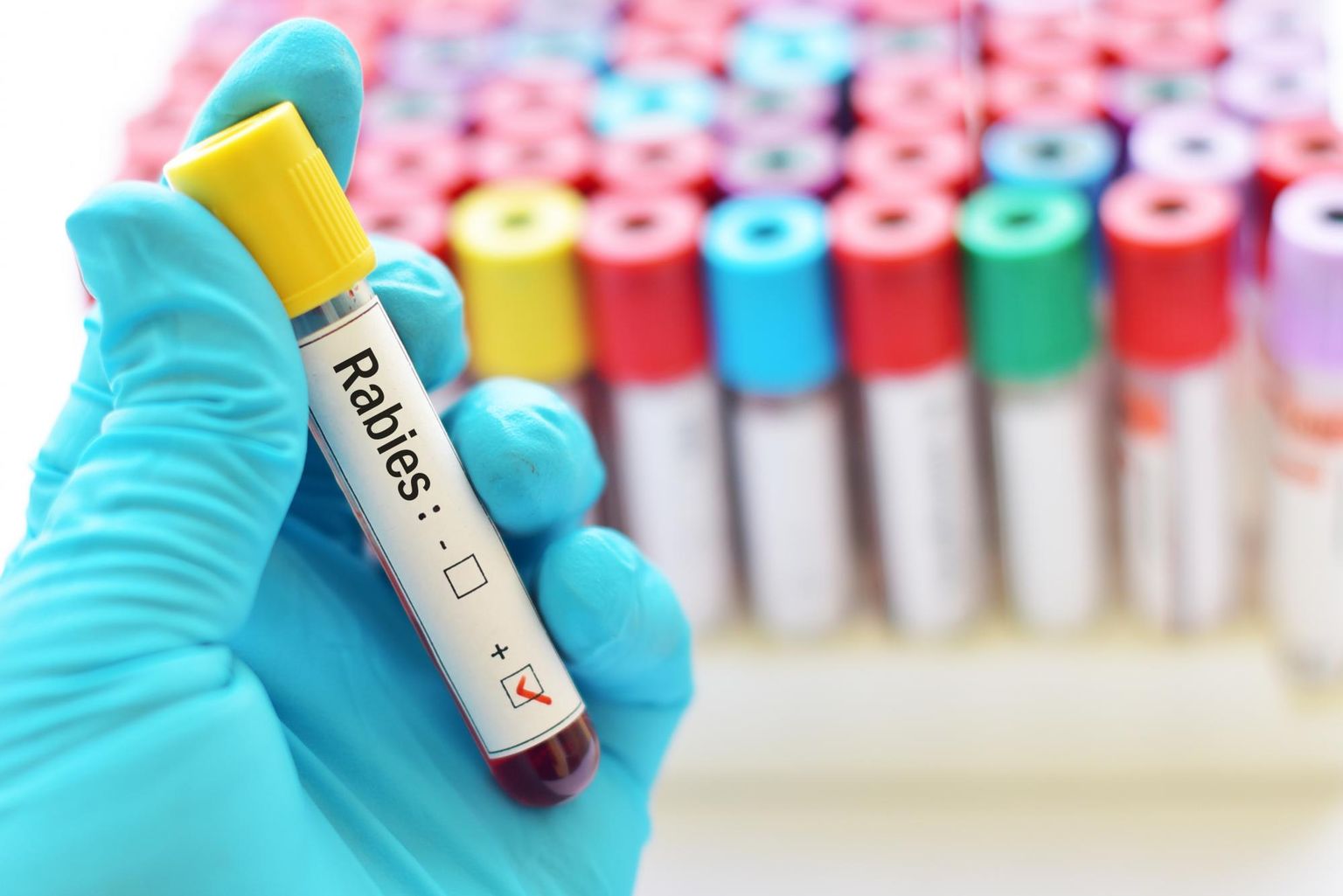 Whole genome sequencing for rapid characterization of rabies virus using nanopore technology