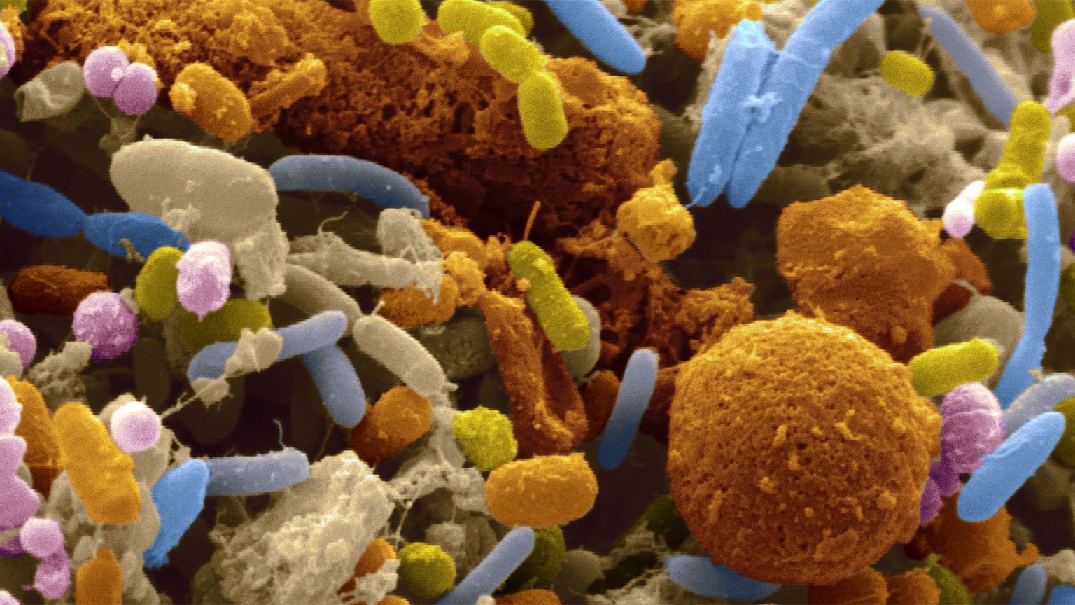 Low cost nanopore sequencing in a front-line clinical microbiology laboratory without on-site bioinformaticians