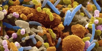 The MiDAS global genome catalogue: 53,501 long-read MAGs representing all core prokaryotic genera in the global activated sludge microbiome